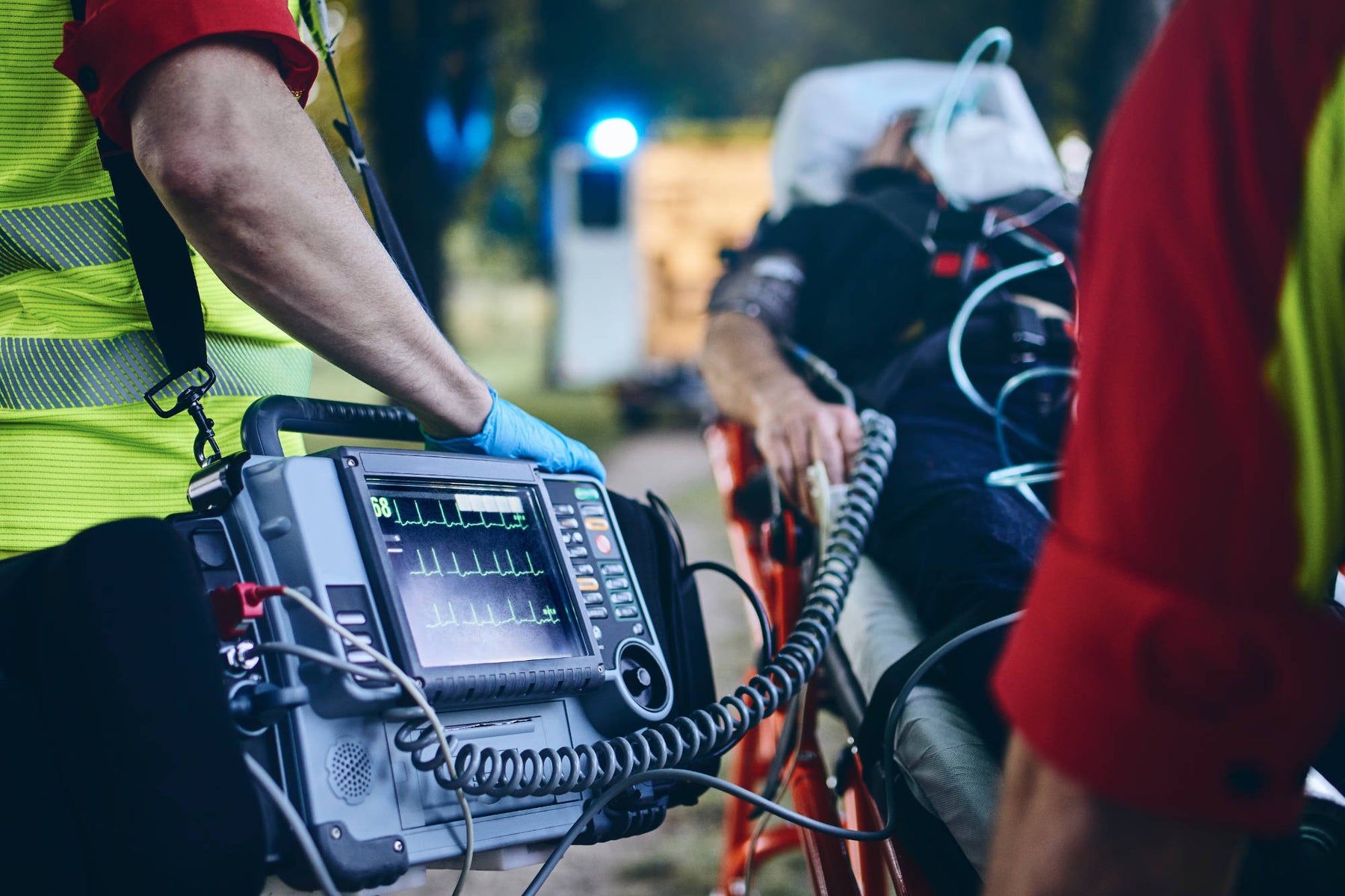 Defibrillator Types: image of Defibrillator with man on stretcher