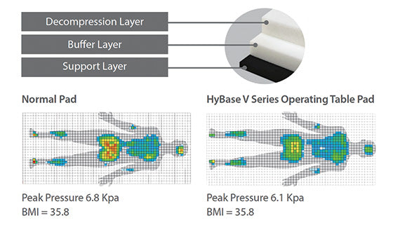 HyBase V6 Surgical Table