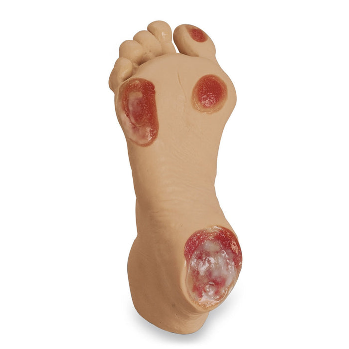 Pressure Ulcer Foot Light - Nasco LF00933